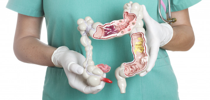 Colon cancer screening