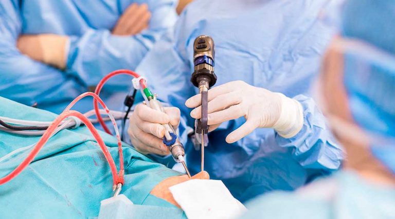 Upper endoscopy procedure